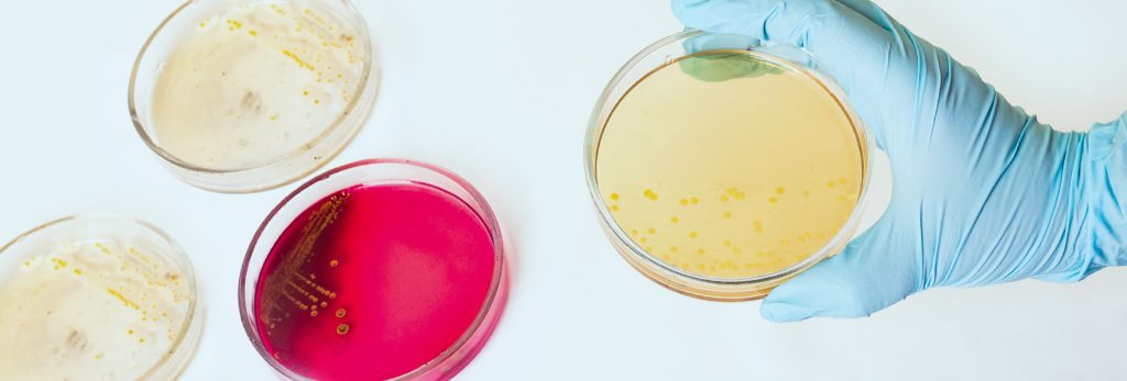Ventajas de contar con preparador de medios de cultivo en tu laboratorio de microbiología o de tejidos vegetales